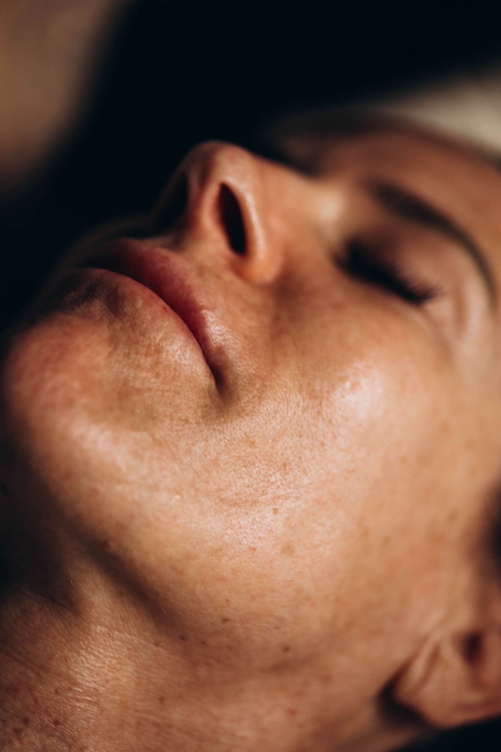 Chemical Peel - Face Foundrie